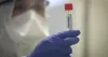 Vignette Coronavirus : le ministre de la Santé annonce la commande de 2 millions de tests - L'Express
