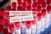 Vignette Confinement et distanciation : jusqu’à 18 mois nécessaires selon des experts | Santé Magazine